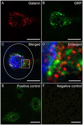 Spinal Cord Injury Causes Reduction of Galanin and Gastrin Releasing Peptide mRNA Expression in the Spinal Ejaculation Generator of Male Rats